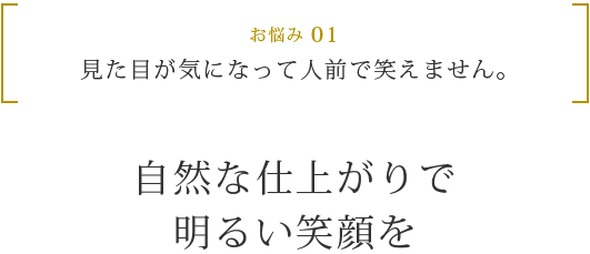 お悩み 01 見た目が気になって人前で笑えません。